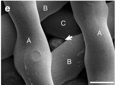 bioprosthetic ovary